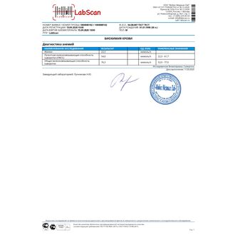 Общая железосвязывающая способность сыворотки (ОЖСС) (включает определение железа, ЛЖСС)