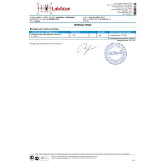 АТ к микросомальной фракции тироцитов (АТ-МАГ)