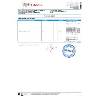 Альфа-фетопротеин (АФП)