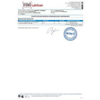 Антитела к ядерному (cor) антигену вируса гепатита В, IgM (Anti-HBc IgM)