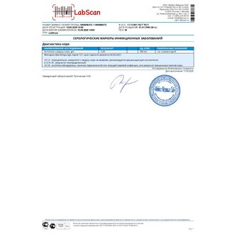 Антитела к вирусу кори, IgG