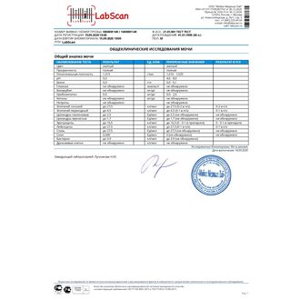 Общий анализ мочи