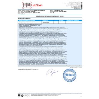 Исследование химического состава конкремента (мочевого камня)